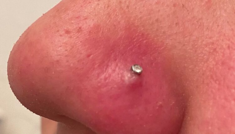 پیرسینگ بینی / نشانههای عفونت پس از پیرسینگ