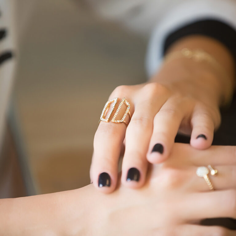 پرسته انگشتر طلا تقارن